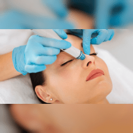 Carbon Laser in Jaipur image