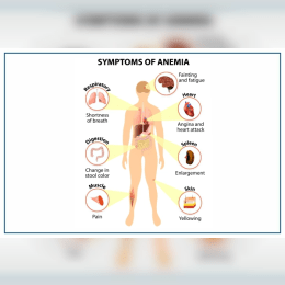 Anaemia Symptoms: Early Signs & Health Risks image