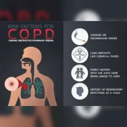 Chronic Obstructive Pulmonary Disease (COPD) image