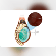 Surgical Sperm Retrieval in Hyderabad: Male Infertility Solution Reviews | RateItAll