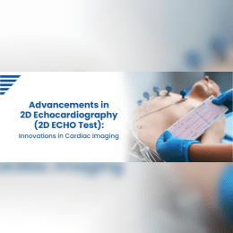 Affordable 2D Echo Test in Hyderabad for Heart Screening image